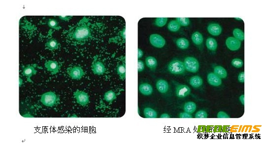 支原體去除試劑MRA具有強的抵制支原體活性，使用方便及作用濃度低，細(xì)胞毒性