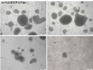 使用Corning? NK細(xì)胞無血清培養(yǎng)試劑盒II 高效地激活和擴(kuò)增人類自然殺傷細(xì)胞 應(yīng)