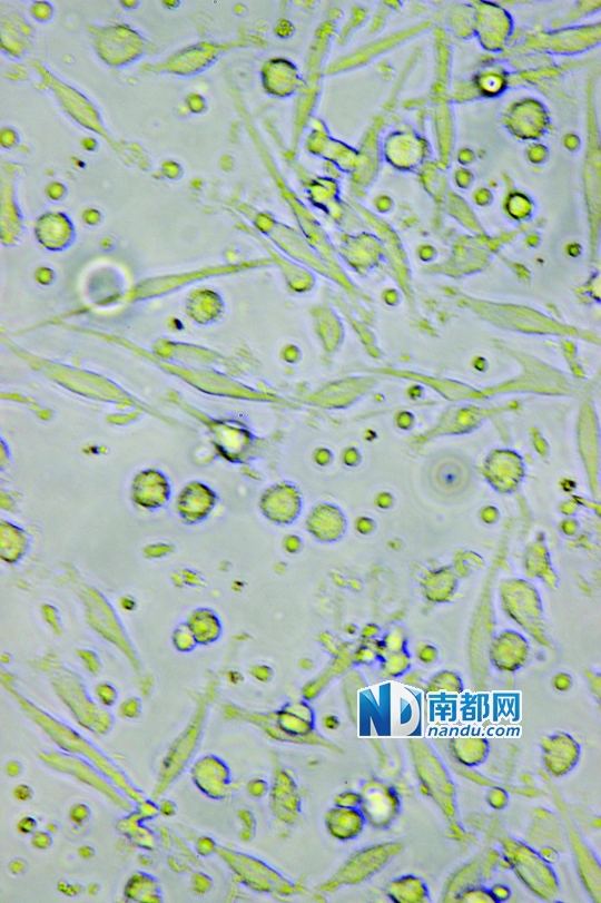 <p>    ↑目前臨床應(yīng)用最廣泛的細(xì)胞生物治療是C IK細(xì)胞治療，在顯微鏡下可清晰看到D C細(xì)胞(葉片形狀)和C IK細(xì)胞(圓點形狀)。</p>